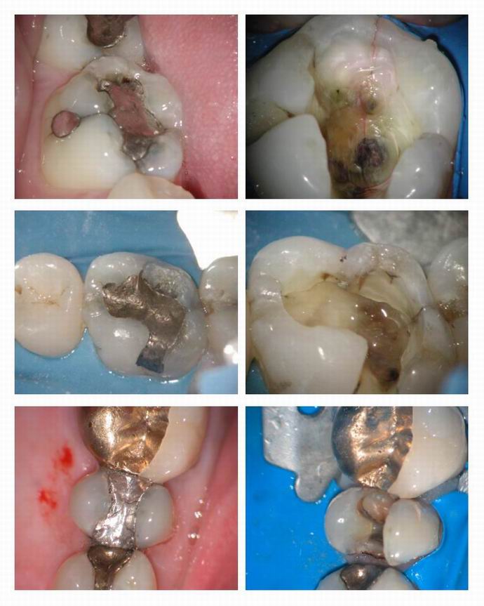 Resize of Cracked teeth pg 3.jpg